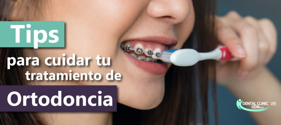 tips-ortodoncia-dental-clinic-gem